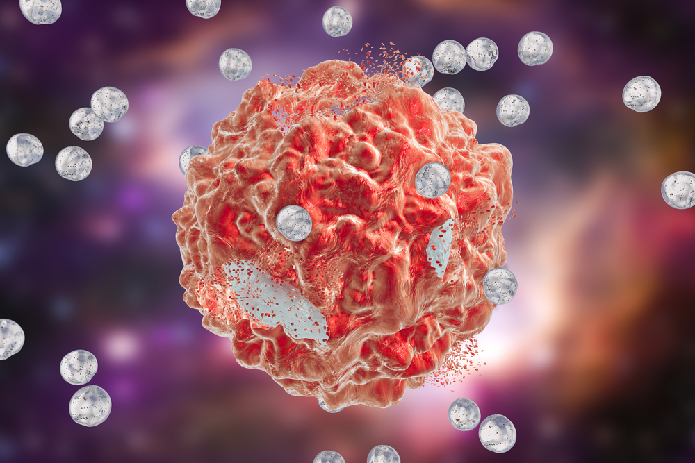 Nanoparticle-Based Cancer Treatment: A Look at its Origins and What's Next  - Drug Discovery and Development